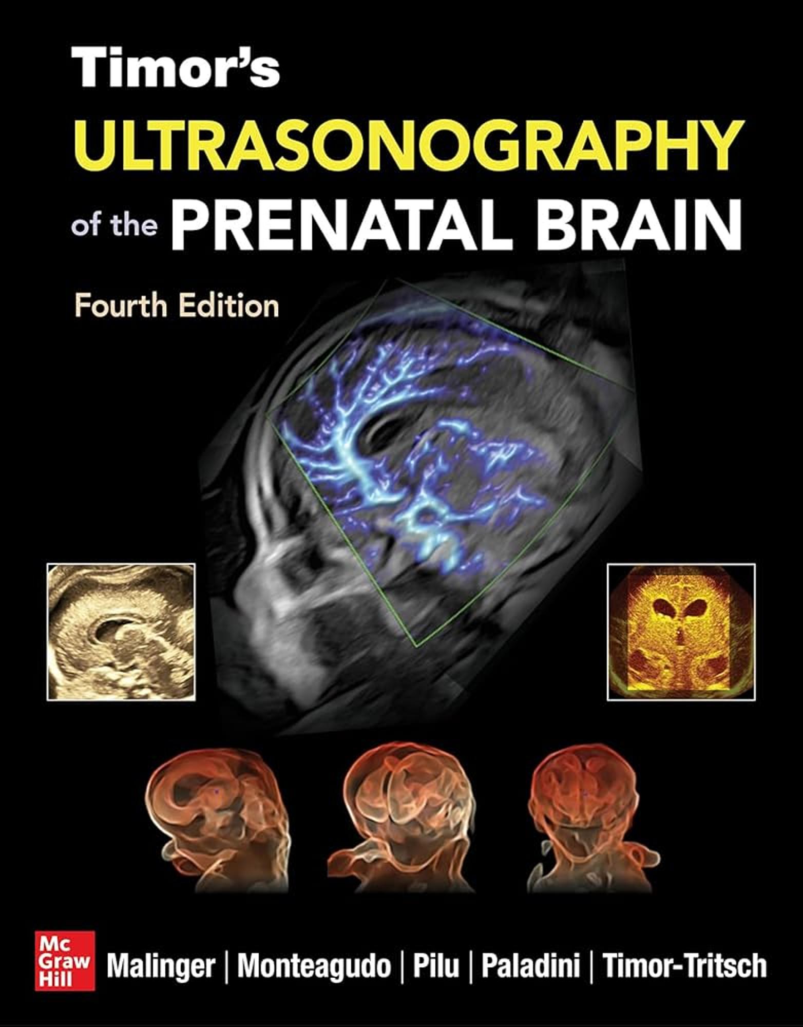 Cover image for Timor's Ultrasonography of the Prenatal Brain