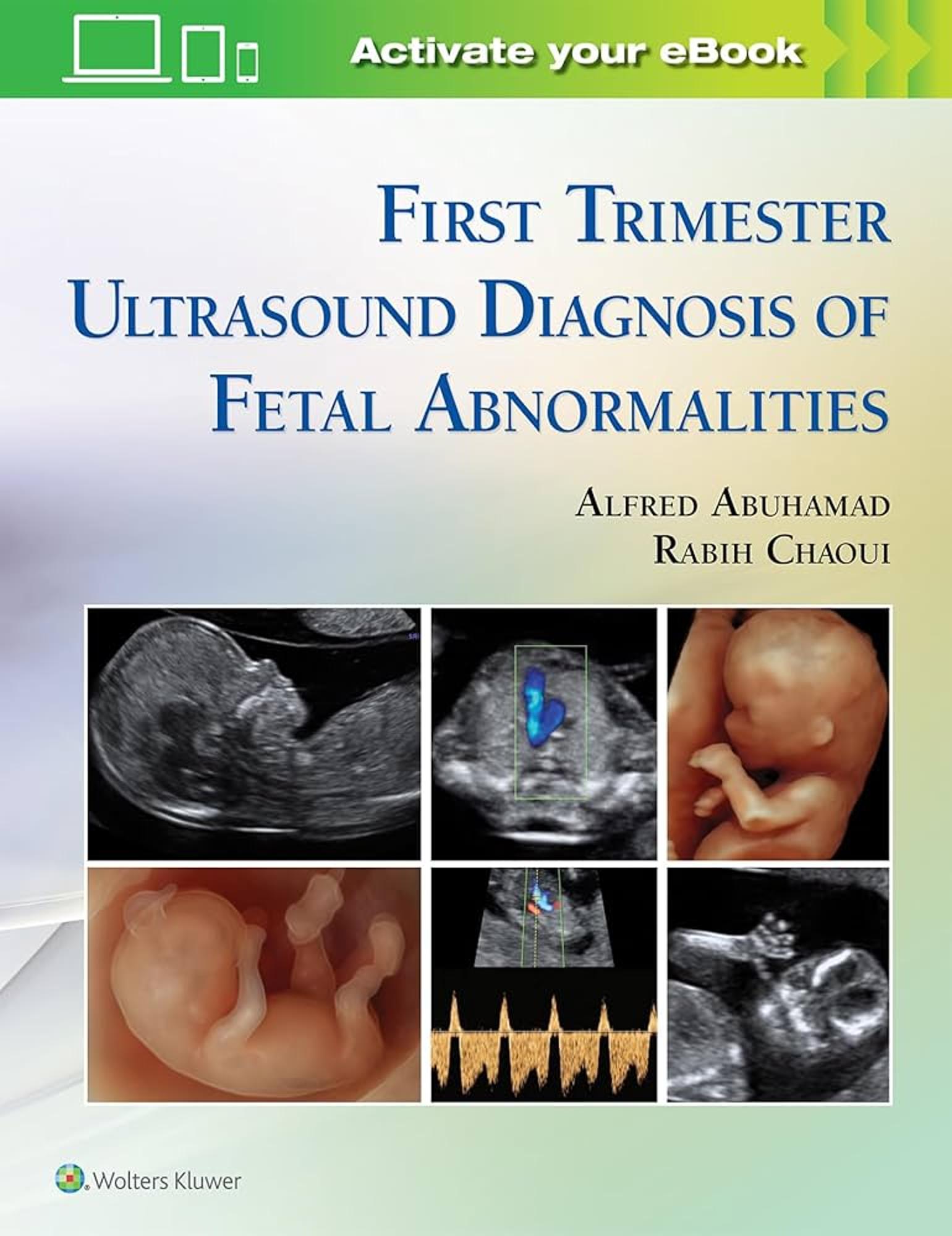 Cover image for Atlas of Ultrasound Anatomy in Late First Trimester